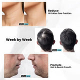 540 Micro Needles Derma Roller - Skin & Hair Care - WHIMSY BARGAIN WAREHOUSE