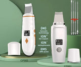 Ultrasonic Facial Skin Scrubber - WHIMSY BARGAIN WAREHOUSE