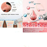 Ultrasonic Facial Skin Scrubber - WHIMSY BARGAIN WAREHOUSE