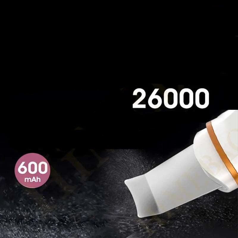 Ultrasonic Facial Skin Scrubber - WHIMSY BARGAIN WAREHOUSE